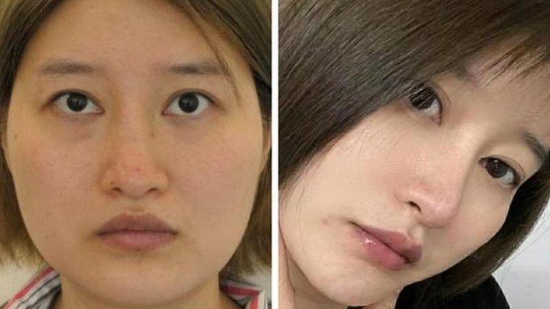 医美产品批发货源：揭秘行业“幕后”供应链