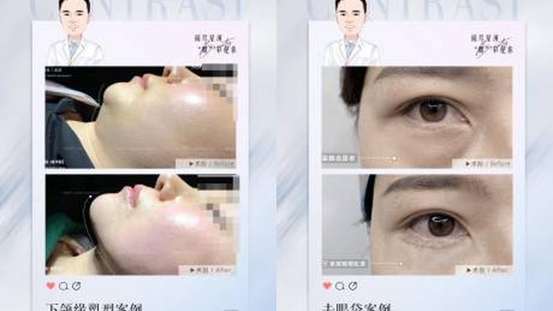 小标题：术后初期，肿胀是正常现象