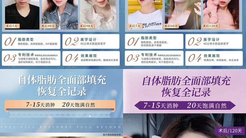 相比传统的拉皮手术，埋线提升具有以下优势：