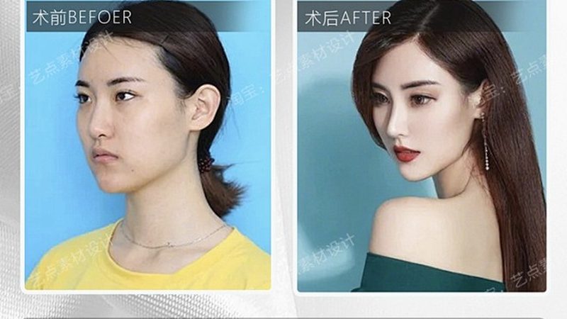 医美术后防晒，你做对了吗？**