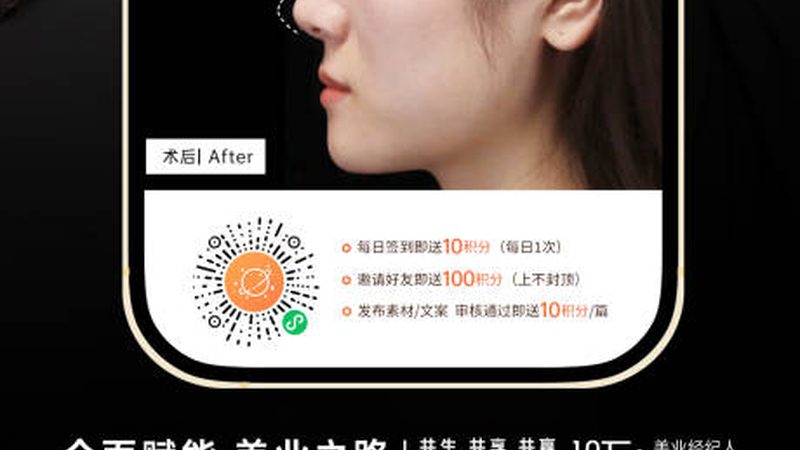 强脉冲光设备：揭秘参数背后的技术奥秘