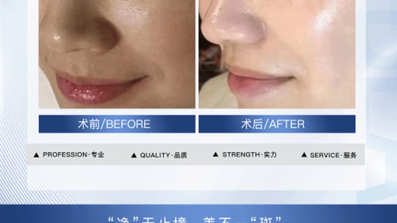 热玛吉代理加盟：别只看品牌，先看懂行业逻辑