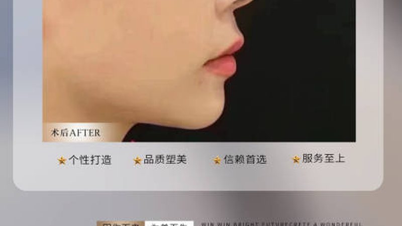下颌角整形：为什么选对医生比选对方案更重要
