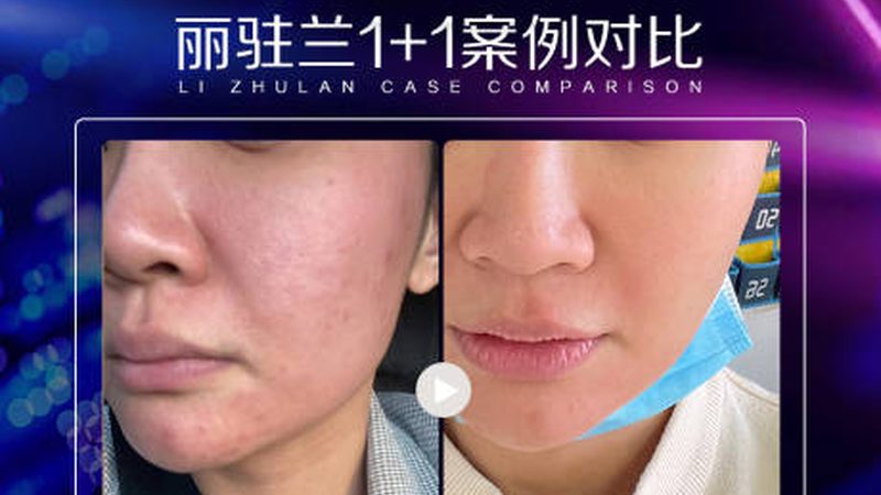 无锡牙齿矫正医院如何挑选？揭秘四大关键因素