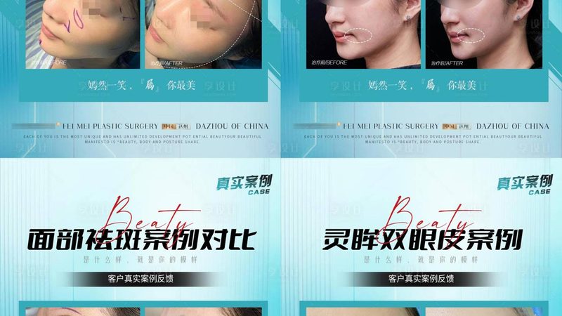 轻医美和医美的适用人群不同