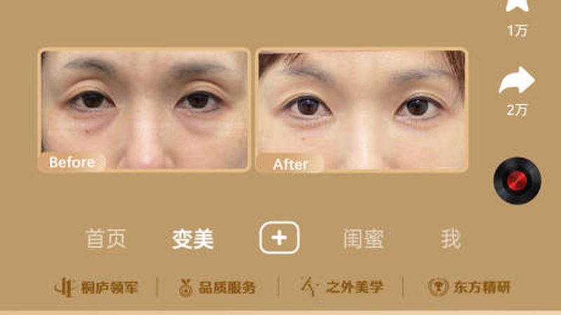 激光祛斑后，美白产品还能用吗？揭秘祛斑与美白的关联