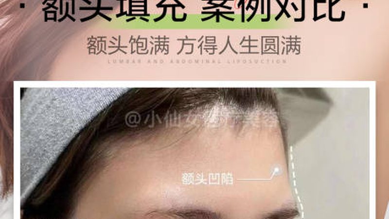 成都激光祛斑仪器：揭秘参数背后的选购智慧